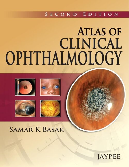 Atlas of Clinical Ophthalmology 2nd Edition