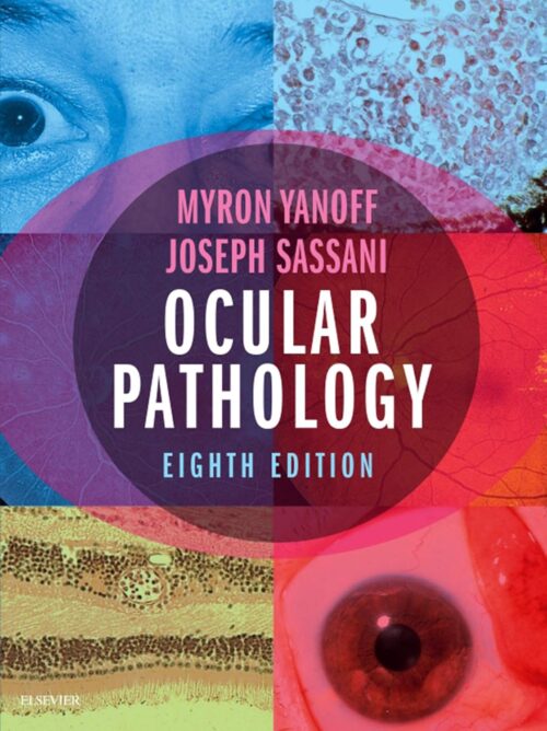 Ocular Pathology 8th Edition