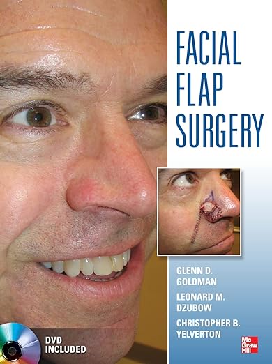 Facial Flaps Surgery 1st Edition