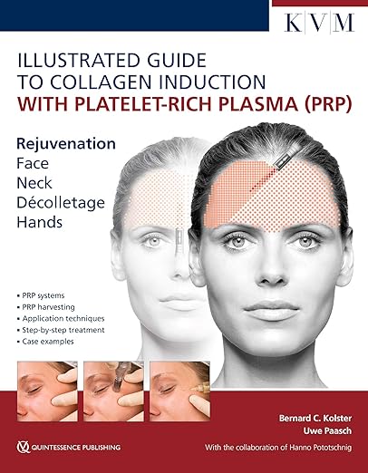 Illustrated Guide to Collagen Induction with Platelet-Rich Plasma (PRP): Rejuvenation Face | Neck | Decollete | Hands Illustrated Edition