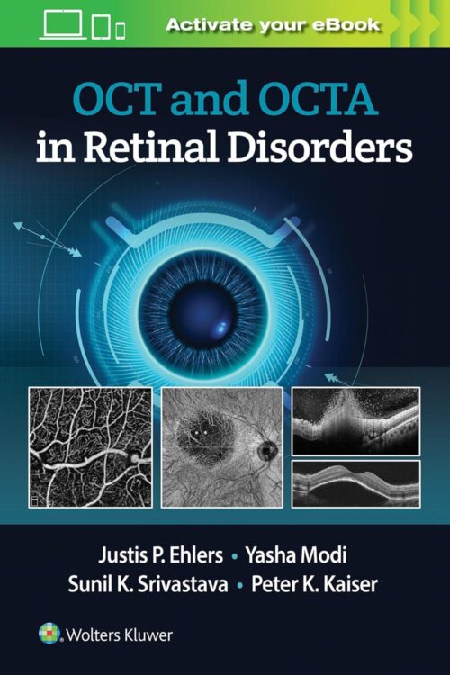 OCT and OCTA in Retinal Disorders 1st Edition