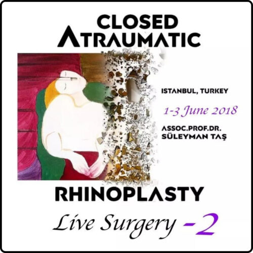 Closed Atraumatic Rhinoplasty Live Surgery DVD 2 2018