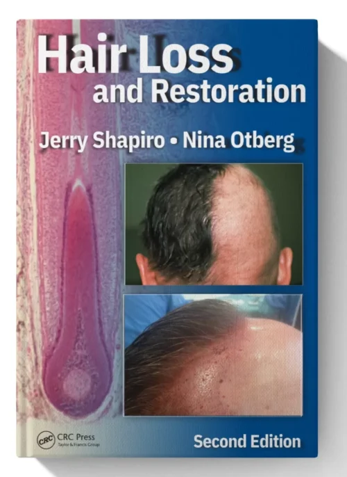Hair Loss and Restoration