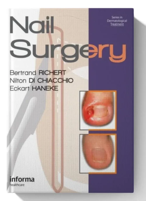 Nail Surgery (Series in Dermatological Treatment)