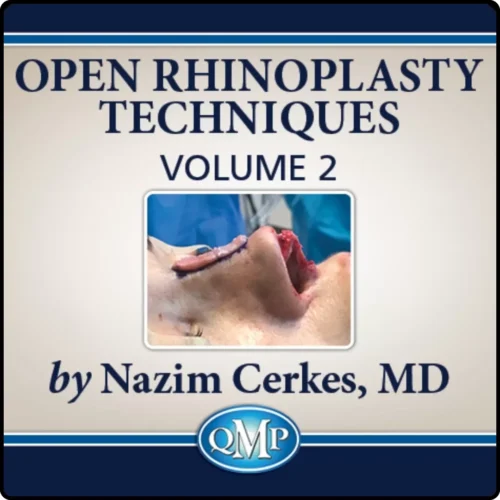 Quality Medical Publishing Open Rhinoplasty Techniques, Volume 2