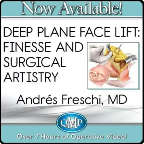Deep Plane Face Lift: Finesse and Surgical Artistry 2023 QMP
