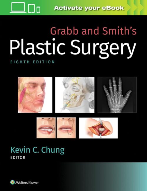 Grabb and Smith's Plastic Surgery 8th Edition