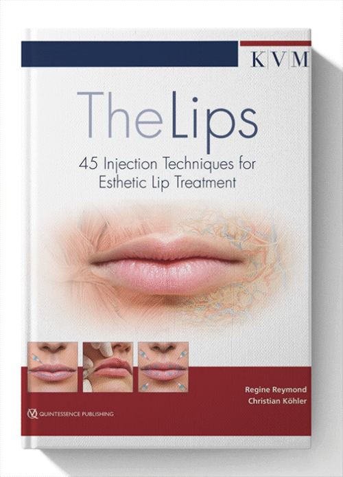 The Lips: 45 Injection Techniques for Esthetic Lip Treatment