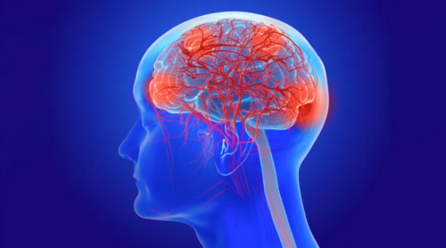 University of Miami Thinking Through Alzheimers 2025