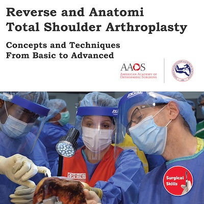 AAOS ASES Anatomic and Reverse Total Shoulder Arthroplasty 2022
